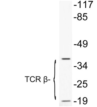 TCR beta antibody