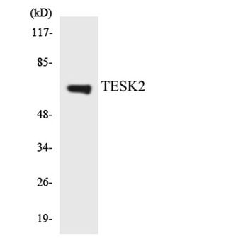 TESK2 rabbit pAb Antibody
