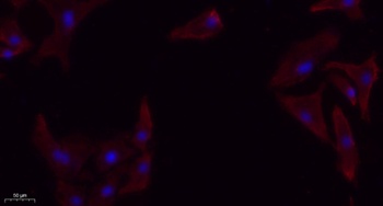 TGFβ RI rabbit pAb