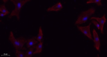 TGF beta RI antibody