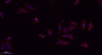 TGFβ1 rabbit pAb