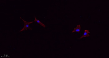 TIMP-1 antibody