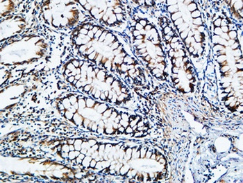 TIMP-2 rabbit pAb Antibody