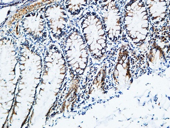 TIMP-2 rabbit pAb Antibody