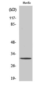 TIMP-3 antibody