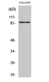 TLK2 rabbit pAb Antibody