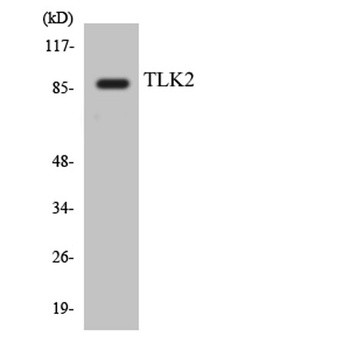 TLK2 rabbit pAb
