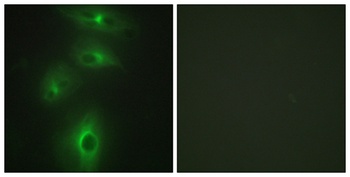 TMPRSS3 rabbit pAb Antibody