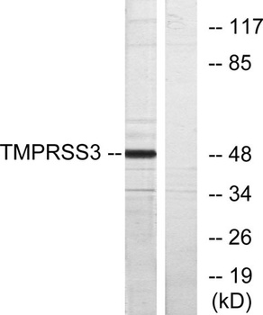 TMPRSS3 rabbit pAb Antibody