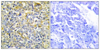 TNF-IP 8 rabbit pAb Antibody