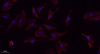 TNF-α rabbit pAb