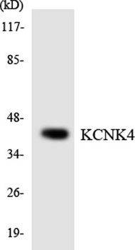 TRAAK rabbit pAb Antibody