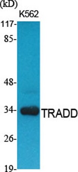 TRADD antibody