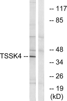 TSSK 4 rabbit pAb Antibody