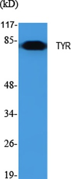 TYR antibody