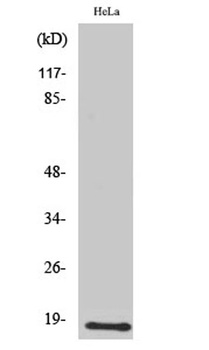 UBE2D2 antibody