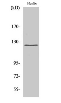UBE3C rabbit pAb Antibody