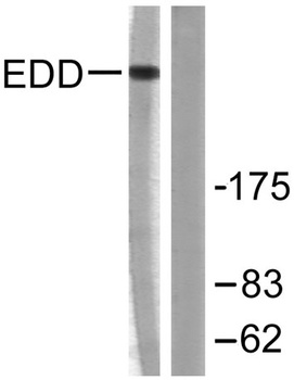 UBR5 rabbit pAb Antibody