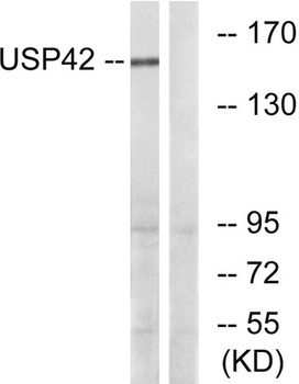 USP42 rabbit pAb Antibody