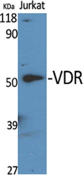 CYP27B1 antibody