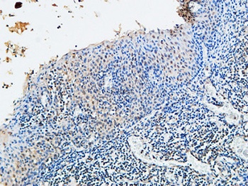 VDR rabbit pAb Antibody