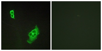 WAVE1 rabbit pAb Antibody