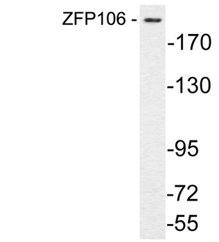 ZFP106 rabbit pAb Antibody