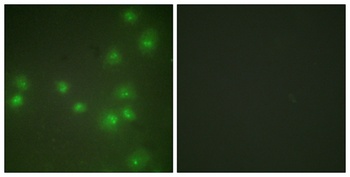 ZIS rabbit pAb Antibody