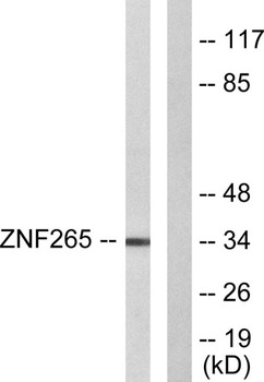 ZIS rabbit pAb Antibody