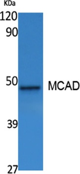 MCAD rabbit pAb Antibody