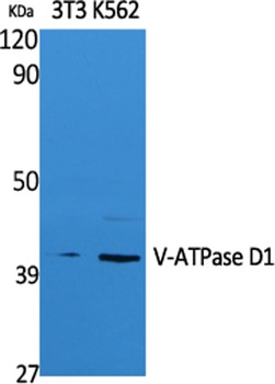 V-ATPase D1 antibody