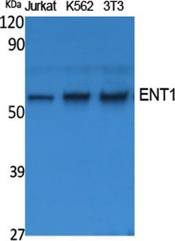 ENT1 antibody