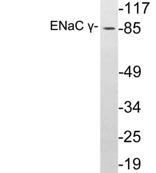 ENaC γ rabbit pAb Antibody