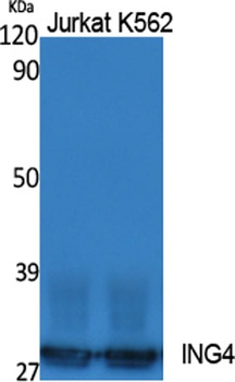 ING4 antibody