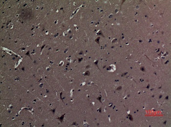 AAT rabbit pAb Antibody