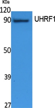 UHRF1 rabbit pAb Antibody