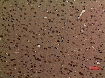 Myosin VI rabbit pAb Antibody