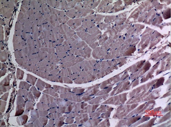 UBE4A rabbit pAb Antibody
