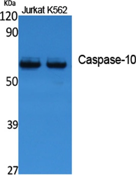 Caspase-10 rabbit pAb Antibody