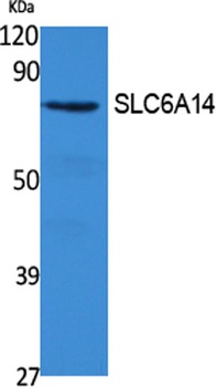 SLC6A14 rabbit pAb