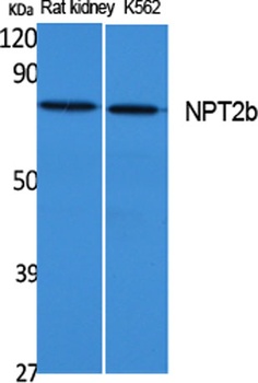 NPT2b antibody