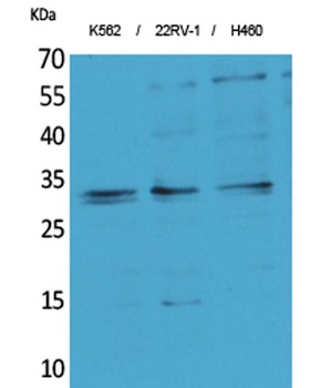 SCP-3 antibody