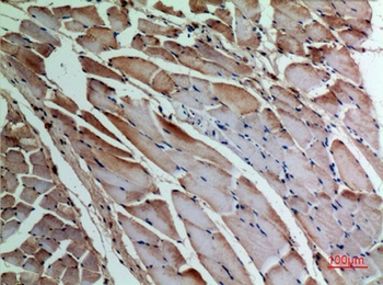 α-SMA rabbit pAb Antibody