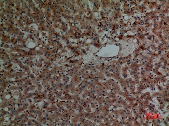 Cathepsin L antibody