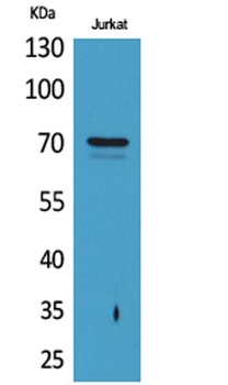 Prothrombin antibody