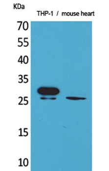 TREM-1 antibody