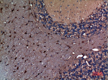 AFP rabbit pAb Antibody
