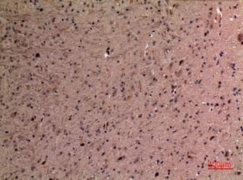 AFP rabbit pAb Antibody