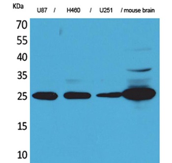 PGP9.5 antibody