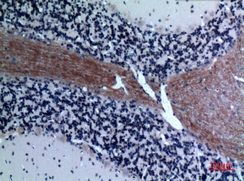 Eotaxin-3 rabbit pAb